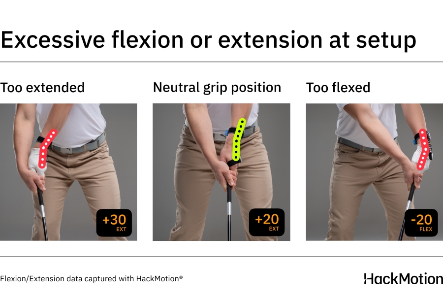 flexion and extension at setup